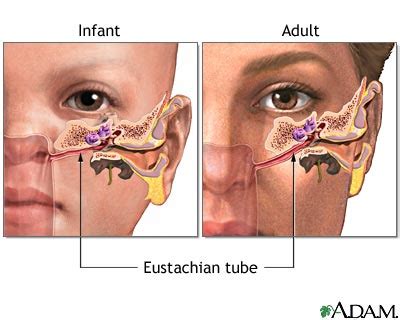 Tips for Treating Blocked Ears - ENT Clinic Sydney