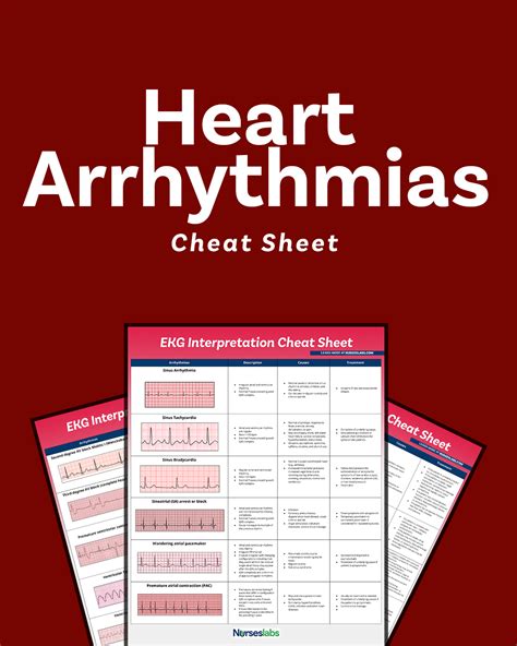 EKG Interpretation Cheat Sheet & Heart Arrhythmias Guide (2020 Update)