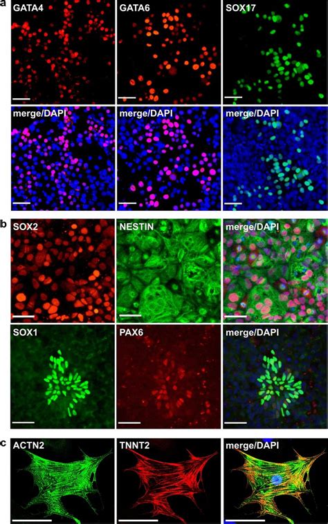 Three germ layer differentiation potential of NWR iPSCs. See also... | Download Scientific Diagram