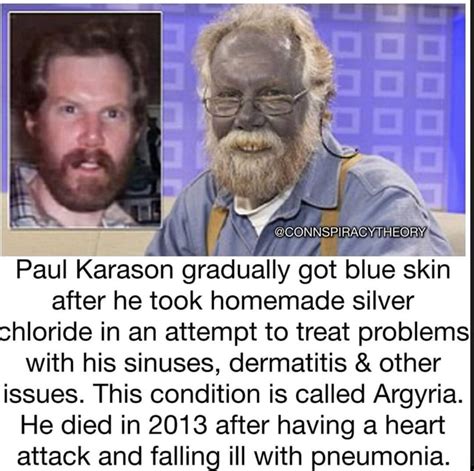 CONNSPIRACY THE I Paul Karason gradually got blue skin after he took homemade silver chloride in ...