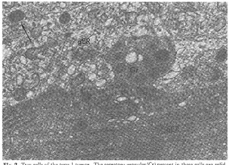 Figure 2 from The fine structure of the human pituitary chromophobe ...