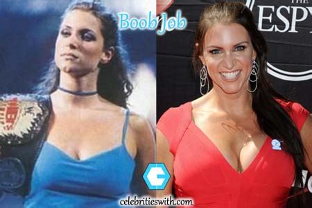 Stephanie McMahon Plastic Surgery: Before After Boob Job Pictures ...