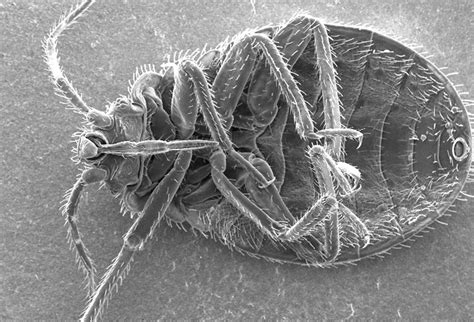 Bedbug | Free Stock Photo | Microscopic bedbug scanning electron micrograph. | # 16709