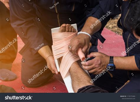 First Aid Unit Splint Broken Bone Stock Photo 1170772489 | Shutterstock