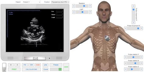 Left Parasternal View. Short axis at the level of papillary muscles