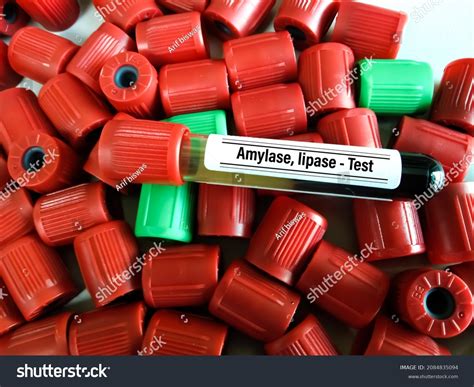 Blood Sample Tube Amylase Lipase Test Stock Photo 2084835094 | Shutterstock