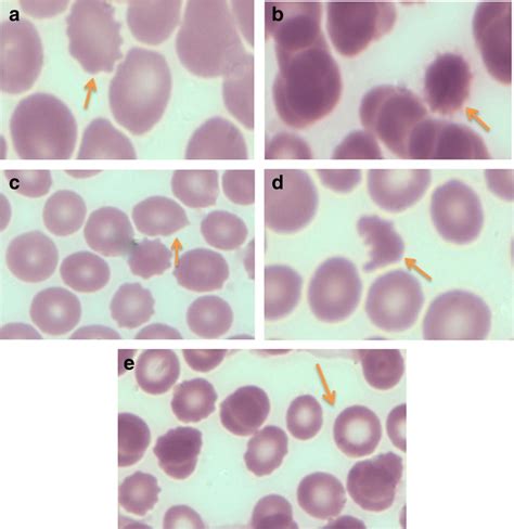 Representations of red blood cell membrane abnormalities from light ...