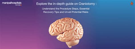 Craniotomy: What It Is, Steps Of The Procedure, Recovery Tips And Risks | by Manipal Hospitals ...