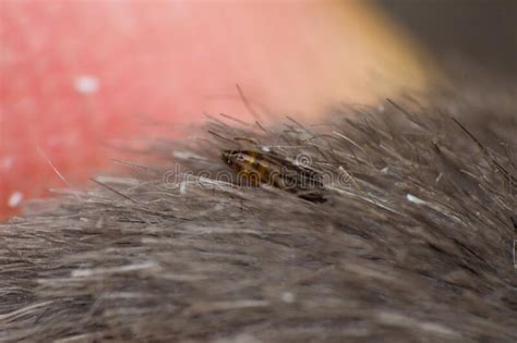 Macro Photo of a Cat Flea on Skin Surface Stock Photo - Image of disease, pulex: 271736274