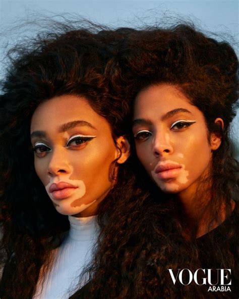 Winnie Harlow for Vogue - Stylish Starlets