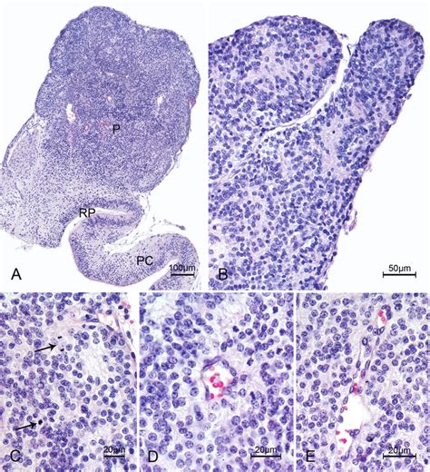 Histological structure of the foetal pineal gland (HE staining). A.... | Download Scientific Diagram