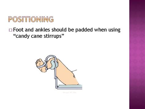 Basic Positions Supine Lithotomy Sitting Prone Lateral Complications