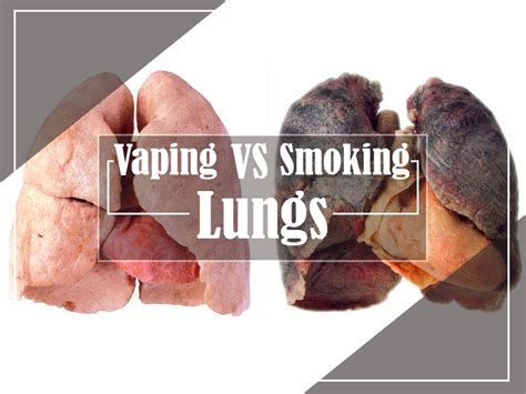 A Study on Vape Lungs vs Smoker Lungs