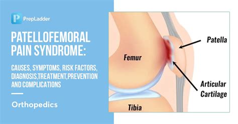 Patellofemoral Pain Syndrome: Causes, Symptoms, Risk Factors, Diagnosis, Treatment and Prevention