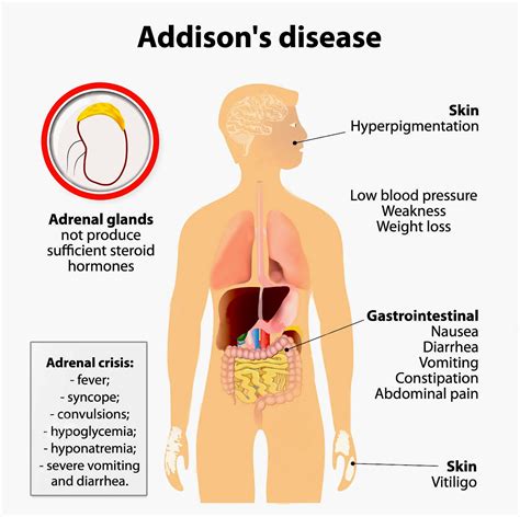 Adrenal glands (the emergency glands) - Online Science Notes