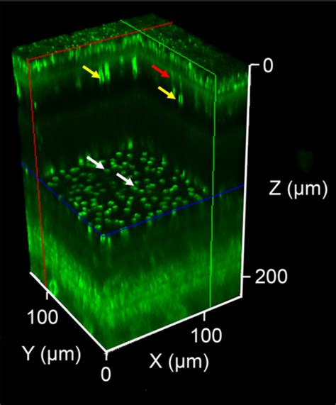 "Two photon vision and two photon eye imaging (2x2-PhotonVis)" project - ICTER