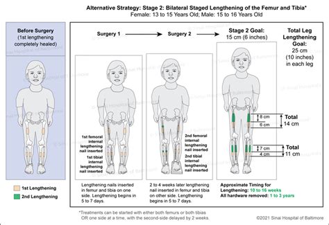 Hypopituitary Dwarfism Vs Achondroplasia