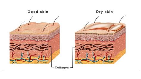 How Does Humidity Affect Your Skin? | Thermopro