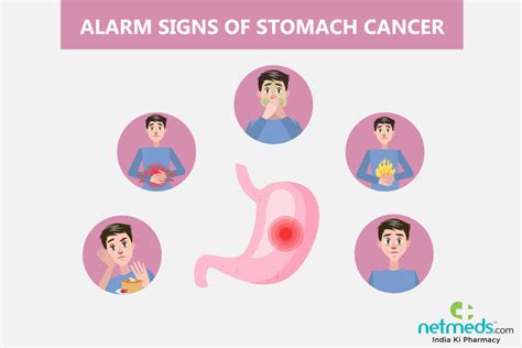 Gastric Cancer: Causes, Symptoms and Treatment | Netmeds