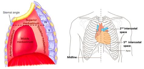 Heart – External Features – Anatomy QA