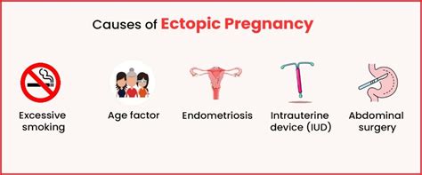 Ectopic Pregnancy - Causes, Symptoms & Treatments