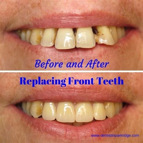 Smile Gallery | Partial dentures, Tooth replacement, Cosmetic dentist