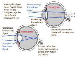 Hyperopia (long-sight) | atelier-yuwa.ciao.jp