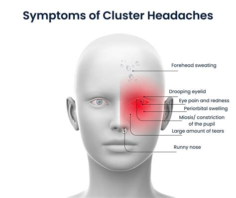 Cluster Headache Treatments in NYC | Pain Management NYC