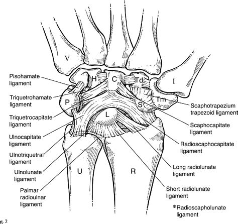 Figure 2 from Ulnar-sided wrist pain: diagnosis and treatment. - Semantic Scholar