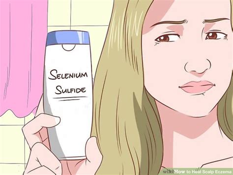 4 Ways to Heal Scalp Eczema - wikiHow