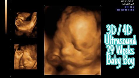 3D/4D ULTRASOUND SCAN / BABY BOY / 29 WEEKS PREGNANT - YouTube