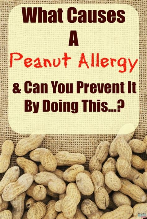 What Causes Peanut Allergy & Can You Prevent It? - Must Have Mom