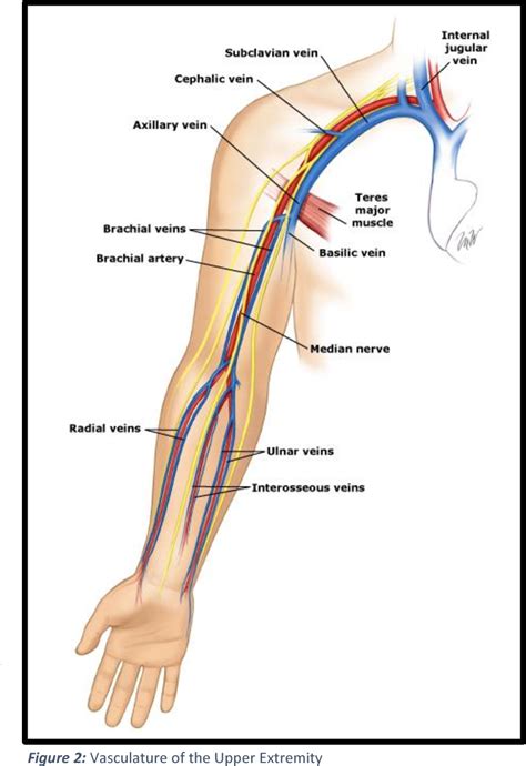 Figure 2 from [Primary deep vein thrombosis of the upper extremity ...