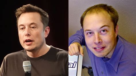Elon Musk: Did the mogul undergo a hair transplant treatment? | Marca