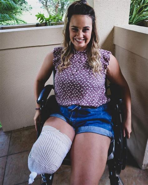 The smile when you finally have your leg amputation after wanting to be one legged your whole life.