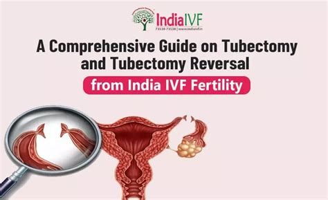 Tubectomy and Tubectomy Reversal: A Comprehensive Guide | India IVF Fertility