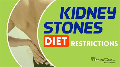 Kidney Stones Diet Restrictions to Pass Stone Painlessly at Home - YouTube