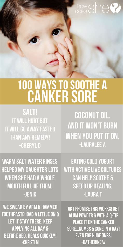 Brilliant ways to soothe a canker sore