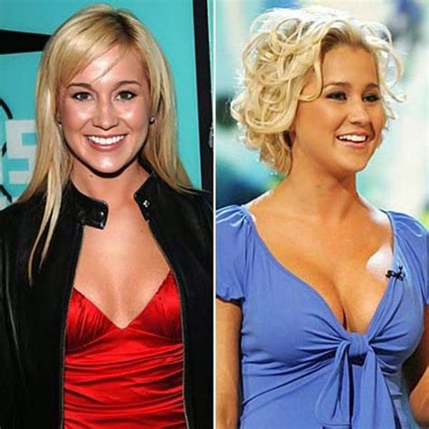 Kellie Pickler Nose Jobs Plastic Surgery Before And After Pictures Zsa ...