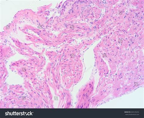 Histology Human Heart Tissue Show Cardiac Stock Photo 634125254 | Shutterstock