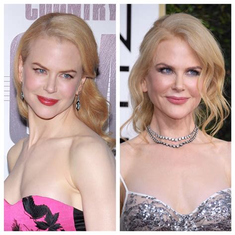 Plastic Surgery? Nicole Kidman's Changing Face Sets Twitter Abuzz ...