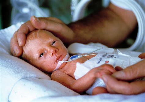 Premature Baby Photograph by John Cole/science Photo Library - Fine Art ...