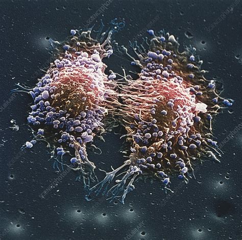 Cancer cell division - Stock Image - M865/0172 - Science Photo Library