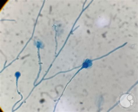 Conidiophores of Aspergillus Fumigatus