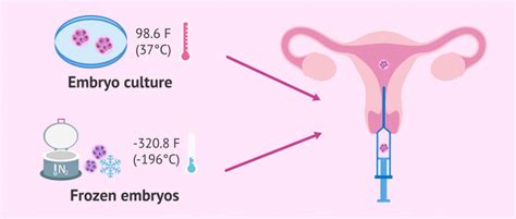 Fresh or frozen embryo transfer