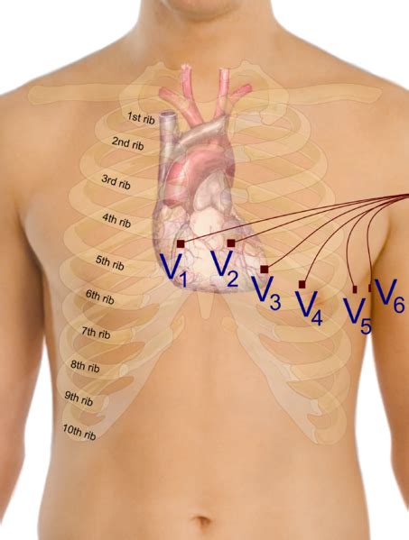 Introduction to ECG - wikidoc
