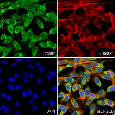 FITC Anti-VCAM1 antibody [EPR5047] (ab223982) | Abcam