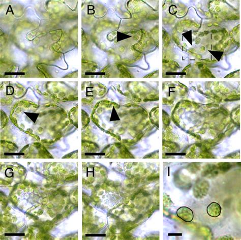 Observation of chloroplasts within subepidermal palisade cells. (A-H ...