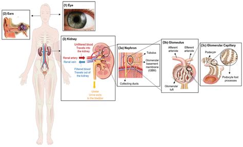 Biomedicines | Free Full-Text | A Current Landscape on Alport Syndrome ...