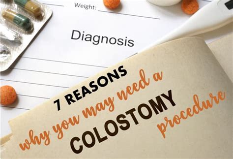 7 Reasons for Colostomy Surgical Procedure - YouMeMindBody